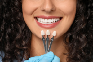 Close up of dentist comparing various veneer shades to a patient’s current veneers